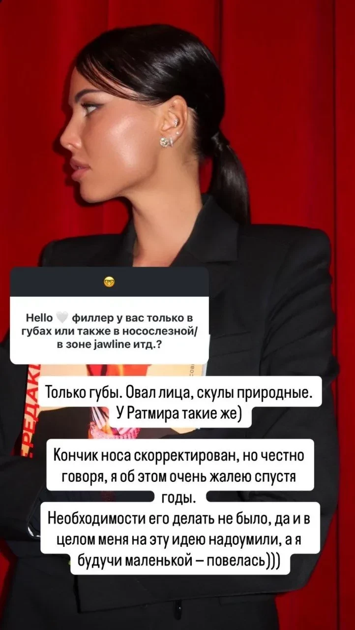 "Скулы природные". Анастасия Решетова рассказала о своих пластических операциях, на которые её "надоумили"