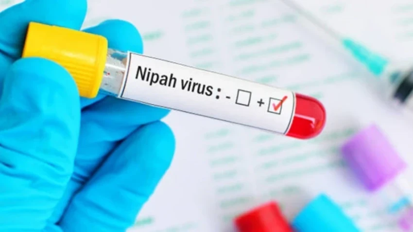 Вирус Nipah: на границах Кыргызстана ввели усиленные меры инфекционной безопасности