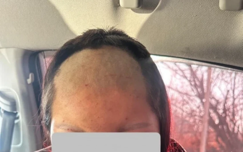 В Джалал-Абадской области несовершеннолетнюю девушку избили и обрили